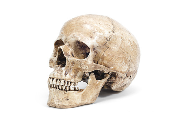 Human-Skull Fragments